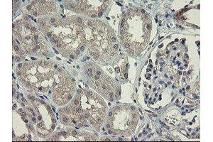 Immunohistochemical staining of paraffin-embedded Human Kidney tissue using anti-CHN1 mouse monoclonal antibody. (CHN1 antibody)