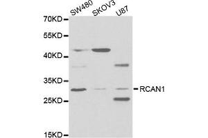 Western Blotting (WB) image for anti-Regulator of Calcineurin 1 (RCAN1) antibody (ABIN1876514) (RCAN1 antibody)