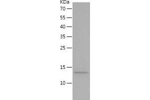 PDGFB Protein (AA 82-190) (His tag)