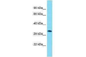Host: Rabbit  Target Name: Aig1  Sample Tissue: Mouse Heart lysates  Antibody Dilution: 1. (AIG1 antibody  (Middle Region))