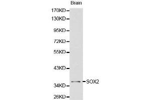 Western Blotting (WB) image for anti-SRY (Sex Determining Region Y)-Box 2 (SOX2) (AA 1-140) antibody (ABIN6213889) (SOX2 antibody  (AA 1-140))