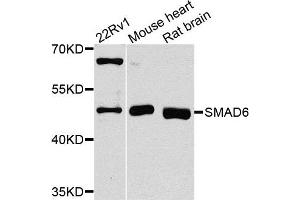 Western blot analysis of extracts of various cells, using SMAD6 antibody. (SMAD6 antibody)