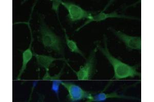 Immunofluorescence analysis of U-251 MG cells using FABP7 Polyclonal Antibody at dilution of 1:100. (FABP7 antibody)