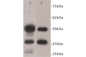 Western Blotting (WB) image for anti-B-cell antigen receptor complex-associated protein alpha chain (CD79A) antibody (ABIN1854863) (CD79a antibody)