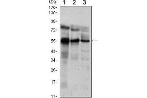 Western blot analysis using ETV5 mouse mAb against Jurkat (1), NIH/3T3 (2) and MCF-7 (3) cell lysate. (ETV5 antibody)