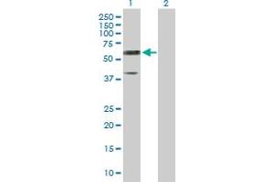 Western Blot analysis of RTN2 expression in transfected 293T cell line by RTN2 MaxPab polyclonal antibody. (Reticulon 2 antibody  (AA 1-472))