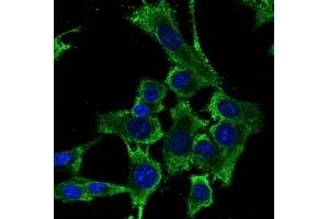 Immunofluorescence (IF) image for anti-Ribosomal Protein S6 (RPS6) (C-Term) antibody (ABIN1440052) (RPS6 antibody  (C-Term))