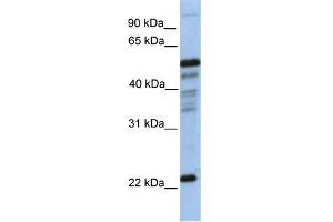 WB Suggested Anti-PGDS Antibody Titration:  0. (PTGDS antibody  (N-Term))