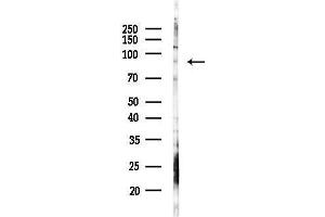 anti-rho GTPase Activating Protein 10 (ARHGAP10) (Internal Region) antibody