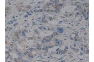 Immunohistochemistry (IHC) image for anti-High Mobility Group Box 1 (HMGB1) (AA 9-163) antibody (ABIN7442177)