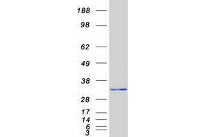 Western Blotting (WB) image for High Mobility Group Box 2 (HMGB2) (Transcript Variant 1) protein (Myc-DYKDDDDK Tag) (ABIN2722873)
