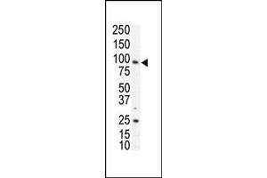 Western blot analysis of anti-AXL N-term Pab (ABIN391876 and ABIN2841696) in SKBR3 cell lysate. (AXL antibody  (N-Term))