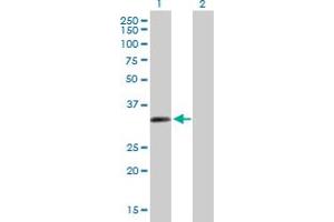 Western Blot analysis of ZNF124 expression in transfected 293T cell line by ZNF124 MaxPab polyclonal antibody. (ZNF124 antibody  (AA 1-289))