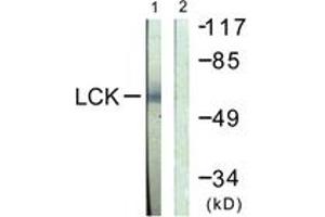 Western blot analysis of extracts from Jurkat cells, using Lck (Ab-505) Antibody.