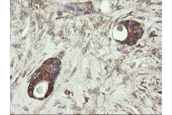 UBE2J1 antibody