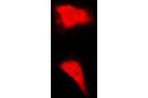 Immunofluorescent analysis of BORIS staining in MCF7 cells. (CTCFL antibody)