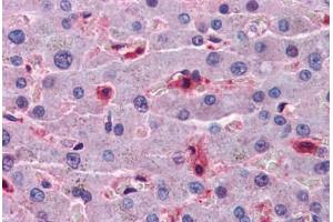 Human Liver: Formalin-Fixed, Paraffin-Embedded (FFPE) (Hepcidin antibody  (AA 25-85))