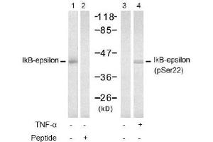 Image no. 2 for anti-Nuclear Factor of kappa Light Polypeptide Gene Enhancer in B-Cells Inhibitor, epsilon (NFKBIE) (Ser22) antibody (ABIN197571) (NFKBIE antibody  (Ser22))