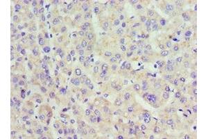Immunohistochemistry of paraffin-embedded human placenta tissue using ABIN7158557 at dilution of 1:100 (ACP1 antibody  (AA 1-158))