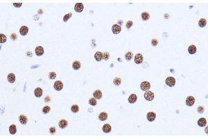 Immunohistochemistry (Paraffin-embedded Sections) (IHC (p)) image for anti-Matrin 3 (MATR3) antibody (ABIN7261858)