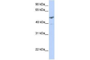ST3GAL1 antibody used at 1 ug/ml to detect target protein. (ST3GAL1 antibody  (C-Term))