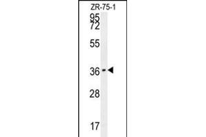CLEC12A Antibody (Center) (ABIN653995 and ABIN2843932) western blot analysis in ZR-75-1 cell line lysates (35 μg/lane). (CLEC12A antibody  (AA 178-206))