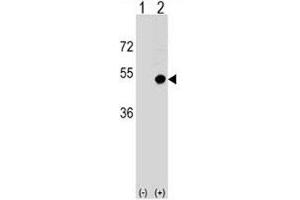 Western blot analysis of CD1d antibody and 293 cell lysate (2 ug/lane) either nontransfected (Lane 1) or transiently transfected (2) with the CD1D gene. (CD1d antibody  (AA 177-206))