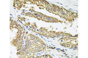 Immunohistochemistry of paraffin-embedded Human prostate using HLA-DQA1 Polyclonal Antibody at dilution of 1:100 (40x lens). (HLA-DQA1 antibody)