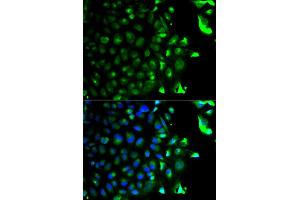 Immunofluorescence analysis of HeLa cells using RAB5A antibody. (RAB5 antibody)