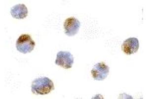 Immunohistochemistry (IHC) image for anti-Induced Myeloid Leukemia Cell Differentiation Protein Mcl-1 (MCL1) (Middle Region) antibody (ABIN1030997) (MCL-1 antibody  (Middle Region))
