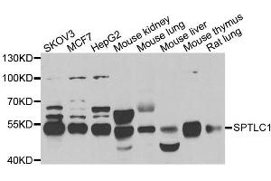 Western blot analysis of extracts of various cell lines, using SPTLC1 antibody. (SPTLC1 antibody  (AA 37-310))