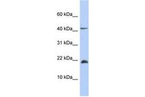 Image no. 1 for anti-SFRS12-Interacting Protein 1 (SFRS12IP1) (AA 71-120) antibody (ABIN6743869) (SFRS12IP1 antibody  (AA 71-120))