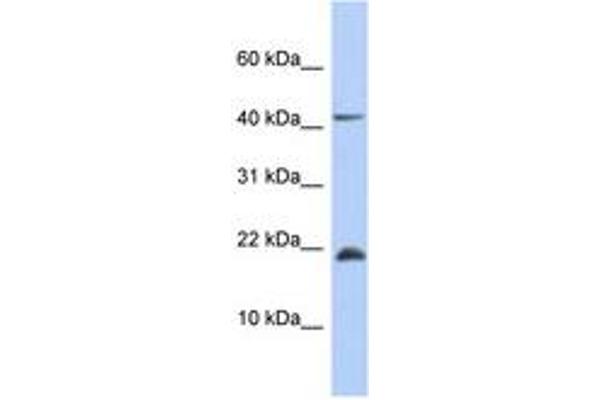 SFRS12IP1 antibody  (AA 71-120)