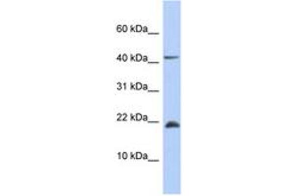 SFRS12IP1 antibody  (AA 71-120)