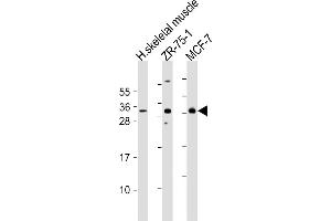 All lanes : Anti-FGF17 Antibody (N-Term) at 1:2000 dilution Lane 1: human skeletal muscle lysates Lane 2: ZR-75-1 whole cell lysates Lane 3: MCF-7 whole cell lysates Lysates/proteins at 20 μg per lane. (FGF17 antibody  (AA 78-112))