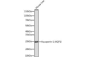 Western blot analysis of extracts of Mouse liver, using Aquaporin-1 (Aquaporin-1 ) Rabbit mAb (ABIN1682901, ABIN3018679, ABIN3018680 and ABIN7101646) at 1:1000 dilution. (Aquaporin 1 antibody)