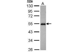 WB Image Sample (30 ug of whole cell lysate) A: Hep G2 , 10% SDS PAGE antibody diluted at 1:1000 (CCDC83 antibody)