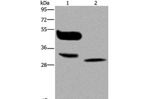 Western Blot analysis of A375 cell and Human lung cancer tissue using MAGEA8 Polyclonal Antibody at dilution of 1:400 (MAGEA8 antibody)