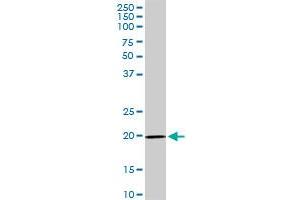 IL17D MaxPab rabbit polyclonal antibody. (IL17D antibody  (AA 1-202))