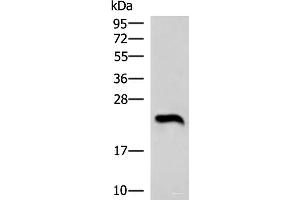 Western blot analysis of Human heart tissue lysate using NEUROG3 Polyclonal Antibody at dilution of 1:1000 (Neurogenin 3 antibody)