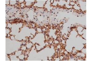 ABIN6267333 at 1/200 staining Mouse lung tissue sections by IHC-P. (SP1 antibody  (pThr453))