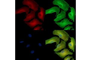 ABIN7095140 and ABIN7099196 staining  cells by IF/ICC.