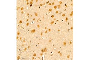 Immunohistochemistry of paraffin embedded rat brain using scr3 (ABIN7074886) at dilution of 1:1000 (400x lens) (NCOA3 antibody)