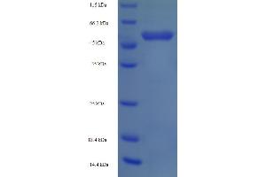 OXCT1 Protein (AA 40-520) (His tag)