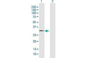 Western Blot analysis of FBXO44 expression in transfected 293T cell line by FBXO44 MaxPab polyclonal antibody. (FBXO44 antibody  (AA 1-224))