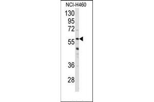 Image no. 1 for anti-Cytochrome P450, Family 3, Subfamily A, Polypeptide 4 (CYP3A4) (Middle Region) antibody (ABIN360097) (CYP3A4 antibody  (Middle Region))