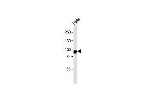 Anti-C Antibody (Center ) at 1:1000 dilution + Hela whole cell lysate Lysates/proteins at 20 μg per lane. (Endoglin antibody  (AA 380-409))