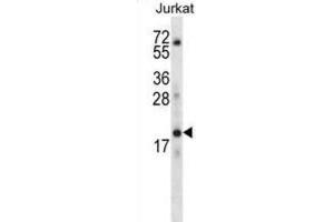 Western Blotting (WB) image for anti-Keratin Associated Protein 13-3 (KRTAP13-3) antibody (ABIN2996741) (KRTAP13-3 antibody)