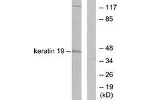 Western blot analysis of extracts from LOVO cells, using Keratin 19 Antibody. (Cytokeratin 19 antibody  (AA 231-280))