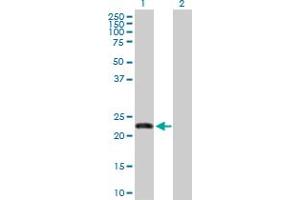 Western Blot analysis of FBXO36 expression in transfected 293T cell line by FBXO36 MaxPab polyclonal antibody.
